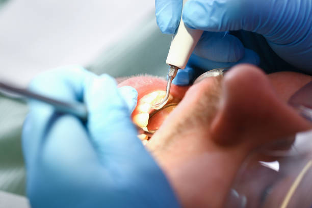 Best Emergency Root Canal Treatment in Elwood, UT