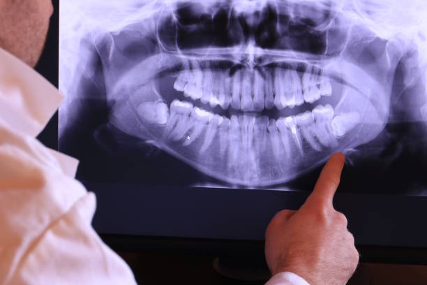 Best Emergency Tooth Extraction in Elwood, UT