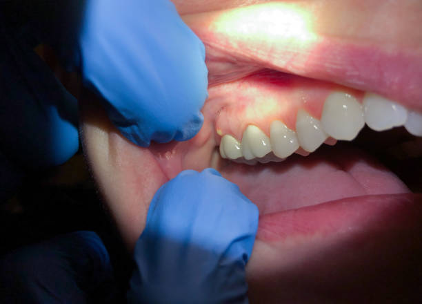 Best Cosmetic Emergency Dentistry in Elwood, UT